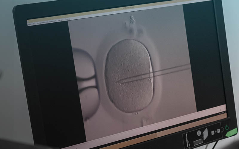 Care Fertility: Transforming IVF with AI